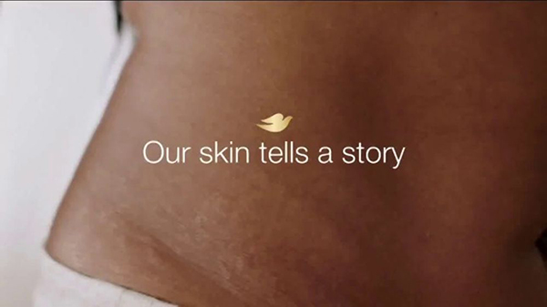 Dove: Skin Stories